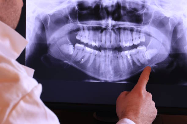 Best Emergency Gum Treatment in Punaluu, HI